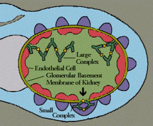 Lupus Eritematoso Sistémico: Etimología, Historia, Epidemiología