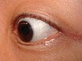Close up of an eye wearing a contact lense