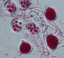 Zoosporangia and zoospores of Phytophthora agathidicida Phytophthora agathidicida sporangia and zoospores.tif