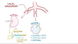 ملف:Preeclampsia & eclampsia.webm