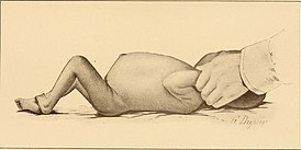 The diseases of infancy and childhood (1910) (14761683704).jpg