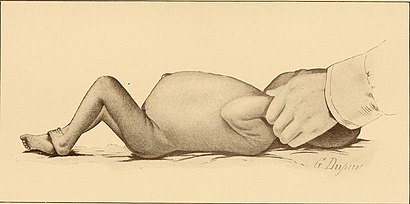 The diseases of infancy and childhood (1910) (14761683704).jpg
