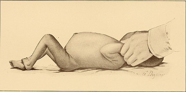 Description de l'image The diseases of infancy and childhood (1910) (14761683704).jpg.