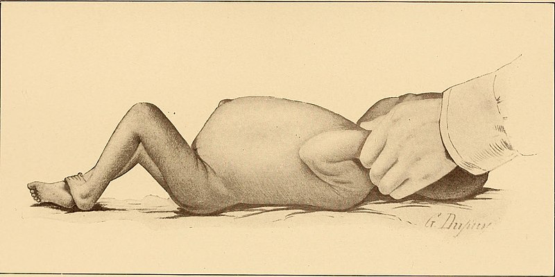 File:The diseases of infancy and childhood (1910) (14761683704).jpg