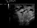 Thumbnail for version as of 13:35, 29 January 2011