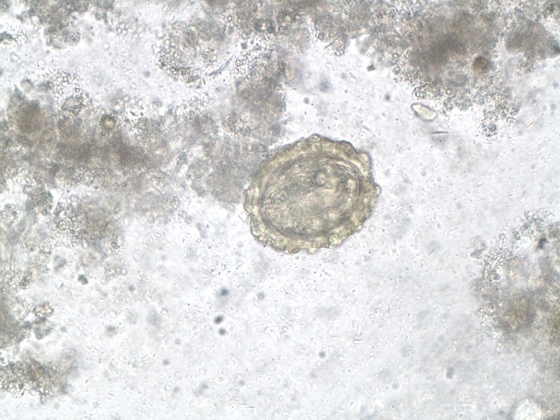 File:Ascaris lumbricoides x400mag (7686861784).jpg