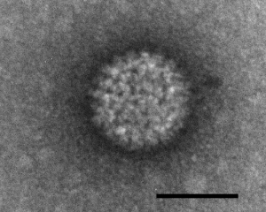 Electron micrograph of "Bluetongue virus", scale bar = 50 nm