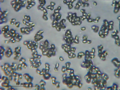 A normal light microscope image of spores