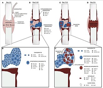 A schematic of endochondral fracture, where B shows the location of both endochondral and intramembranous ossification. Endo Fracture.jpg