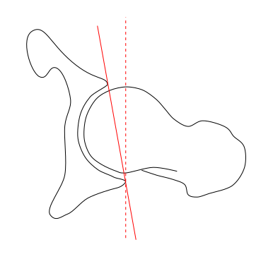 File:Hip-sagittal-angle-000.svg