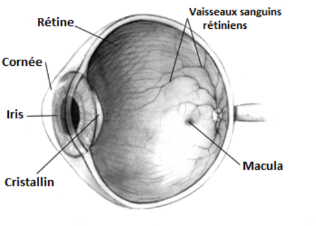 Glaucome