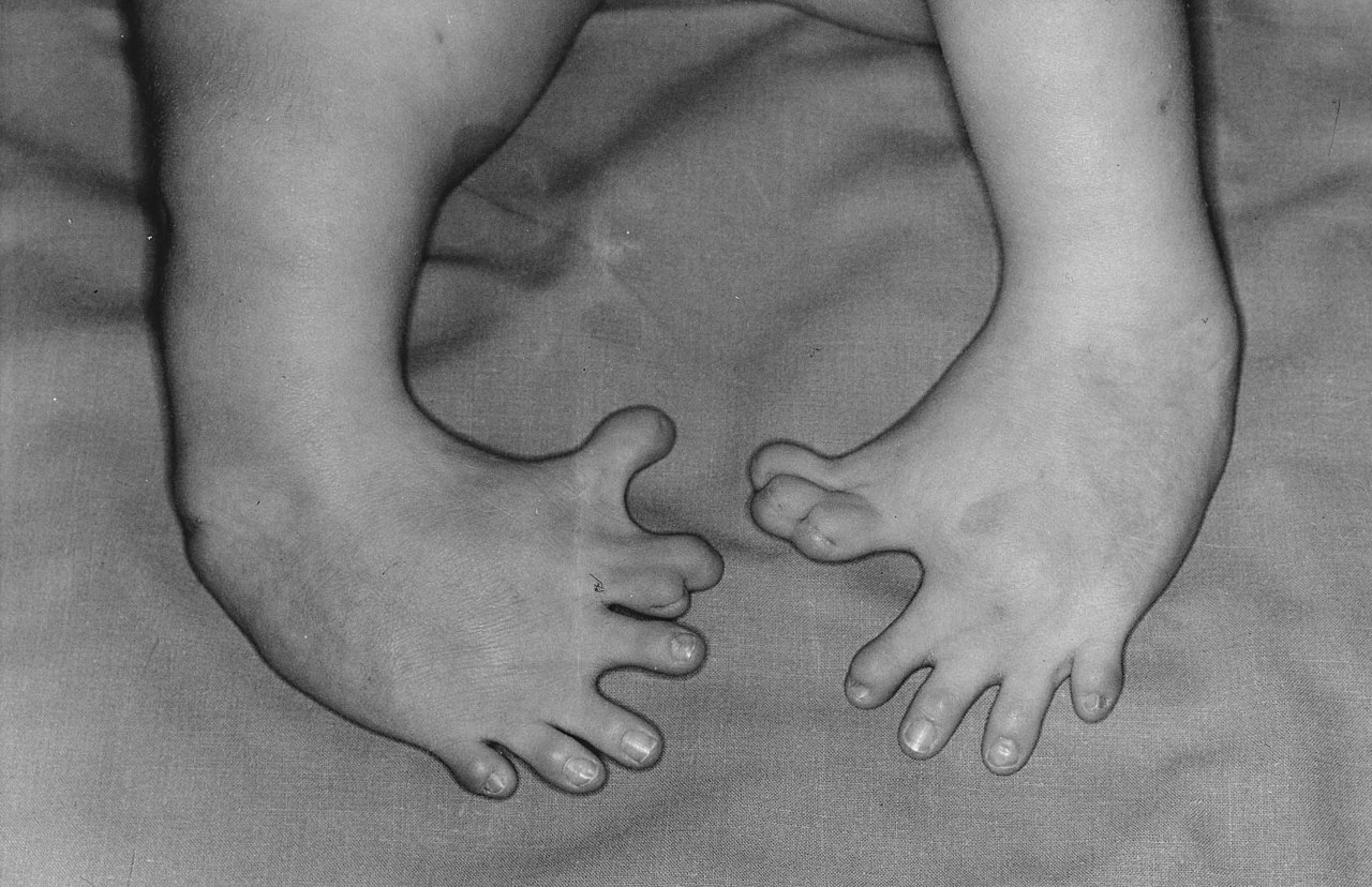 File:Soles Of Human Feet.jpg - Wikimedia Commons