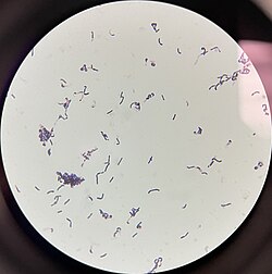 1000x Magnification of Gram Stain of Ligilactobacillus animalis Under Brightfield Microscopy.jpg