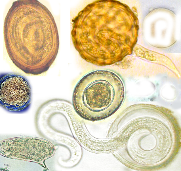 File:Collage Helminth eggs.png