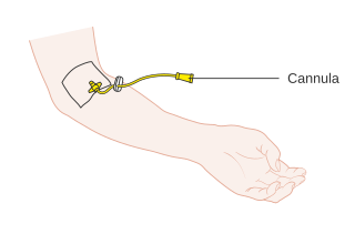 Diagram showing a cannula