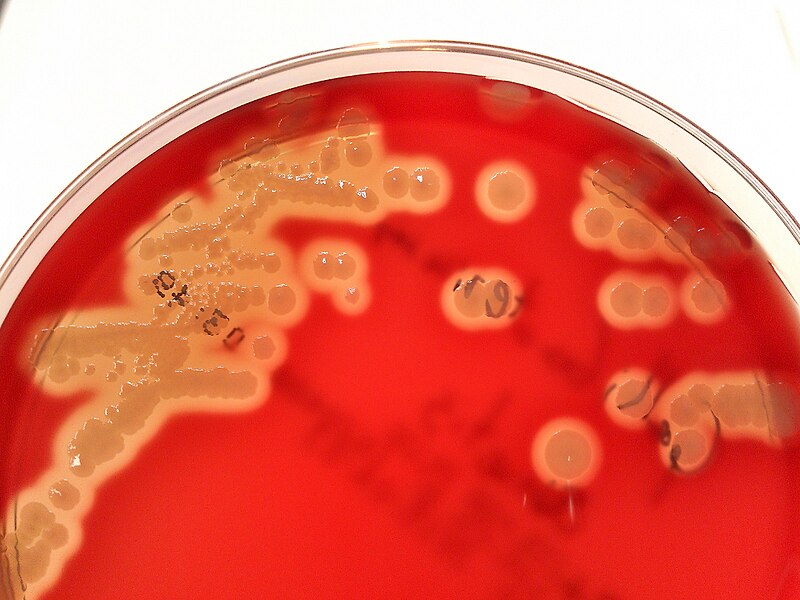 File:Gallibacterium anatis after 48h.jpg