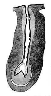 Drawing of a transverse section of the dart sac (also known as the bursa telae) of Helix pomatia during the process of creating a new love dart Helix pomatia dart sac ex Meisenheimer.jpg