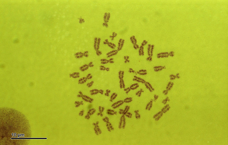 File:Human karyotype (259 35) Karyotype Human 46,XY (man).jpg