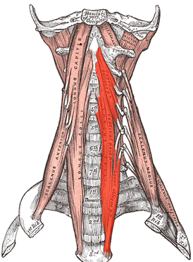 Длинная мышца шеи выделена красным