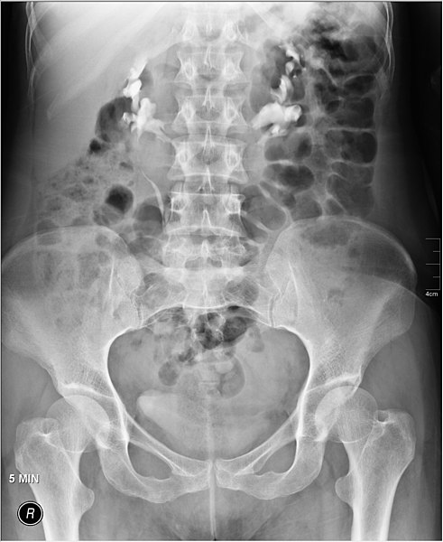 File:Medical X-Ray imaging CNL03 nevit.jpg