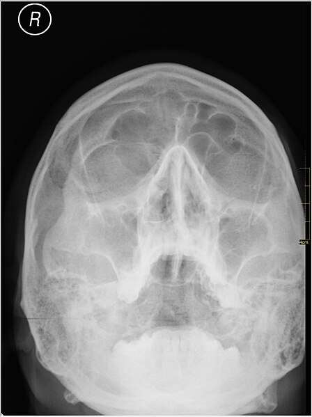 File:Medical X-Ray imaging VJI07 nevit.jpg