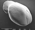 Benthic foraminifera Oridorsalis umbonatus