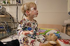 Pediatric polysomnography patient
Children's Hospital Pediatric polysomnogram.jpg