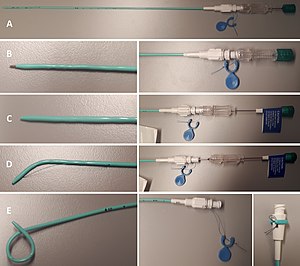 Various settings of a 6 French pigtail catheter with locking string, obturator (also called stiffening cannula) and puncture needle.
A. Overview
B. Both puncture needle and obturator engaged, allowing for direct insertion.
C. Puncture needle retracted. Obturator engaged. Used for example in steady advancement of the catheter on a guidewire previously inserted into the renal pelvis through a thin needle.
D. Both obturator and puncture needle retracted, when the catheter is in the renal pelvis.
E. Locking string is pulled (bottom center) and then wrapped and attach to the superficial end of the catheter. Pigtail catheter settings.jpg