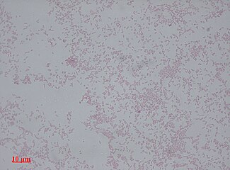 Proteus mirabilis appears as Gram-negative rods after Gram staining under bright-field microscopy with 1000 times magnification.