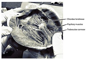 2010 Chordae Tendinae Papillary Muscles.jpg