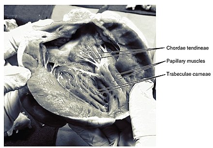 Frontal section showing papillary muscles attached to the tricuspid valve on the right and to the mitral valve on the left via chordae tendineae.[7]
