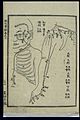 Acu-moxa chart; Small intestine channel of hand taiyang Wellcome L0037978.jpg