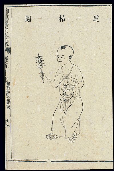 File:Chinese C18; Paediatric pox - 'Dry and Wizened' pox Wellcome L0039865.jpg