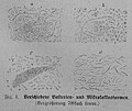 Die Gartenlaube (1879) b 063 1.jpg Fig. 1. Verschiedene Bakterien- und Mikrokokkusformen