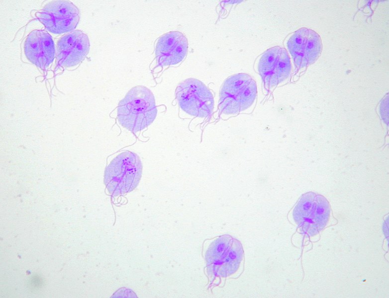 File:Giardia trophozoites Giemsa.tif