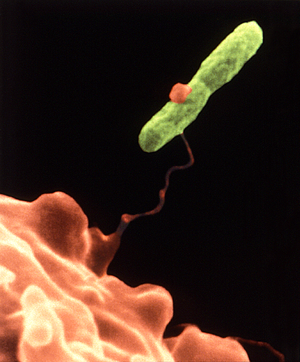 Legionella: Észlelés, Pathogenezis, Molekuláris biológia