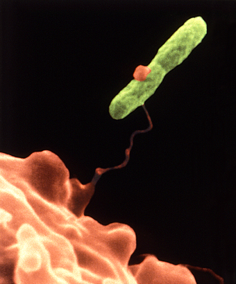 A Legionella pneumophila bacterium (green) caught by a Vermamoeba vermiformis amoeba (orange)