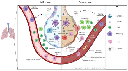 Mild versus severe immune response during virus infection