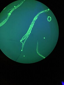 Caenorhabditis Elegans under a microscope Nematode Caenorhabditis Elegans.jpg