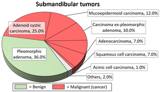 Relative incidence of submandibular tumors, with pleomorphic adenoma being the most common. Relative incidence of submandibular tumors.png