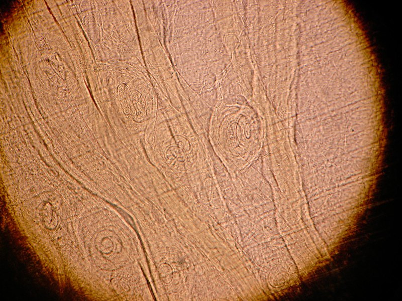 File:Trichinella spiralis (14215753738).jpg