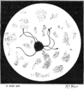 Thumbnail for File:Tropical Diseases - Fig 3.png