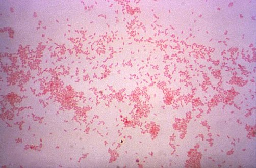 Processed using the Gram-stain method, photomicrograph revealed the presence of numerous Gram-negative, coccobacillus, Brucella suis bacteria.