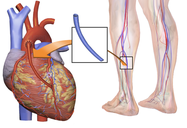 Miokardio Infartu Akutu: Klinika, Etiologia, Diagnostikoa