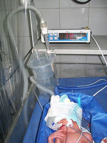 File:CPAP on newborn.JPG