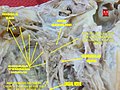 Chorda tympani nerve 2.jpg