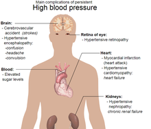 Blood Pressure and Your Brain 