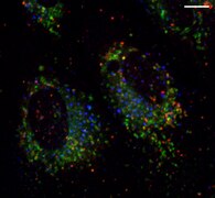 Endosomes in MSCs.tif