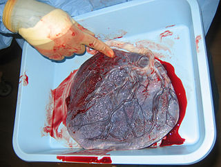 <span class="mw-page-title-main">Placenta</span> Organ that connects the fetus to the uterine wall