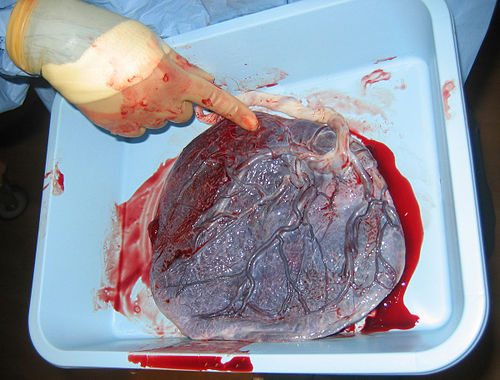 Human placenta baby side.jpg
